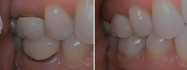 dental work done by Dr. Barrera for an emergency case
