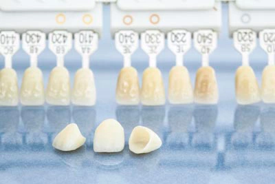 photo of a tooth shading chart