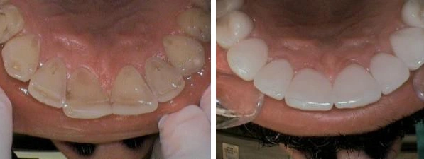 cosmetic dentistry performed by Dr. Barrera