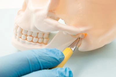 model of a human skull showing TMJ pain area