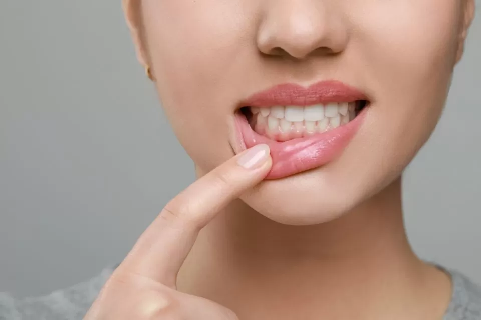 Woman Showing Healthy Gums